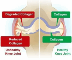 Benefits of Joint Glide